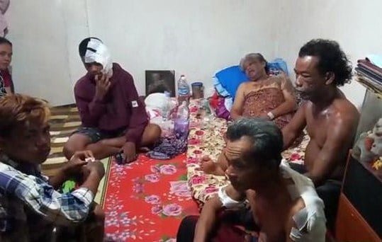 Sadis..!! OTK Siram Air Keras 1 Keluarga di Palembang