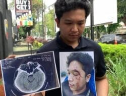 Diduga Anak Kasat Narkoba, Tawarkan Rp 15 Jt Untuk Uang Damai, Usai Aniaya Mahasiswa FK UISU