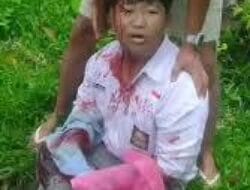 Begal Sadis, Dua Pelaku Ditembak Polisi. Pembacok Pelajar SMA di Binjai Diringkus