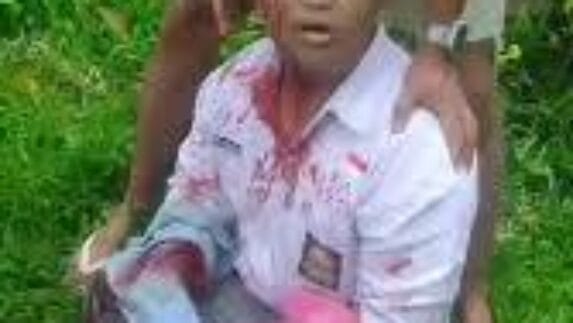 Begal Sadis, Dua Pelaku Ditembak Polisi. Pembacok Pelajar SMA di Binjai Diringkus